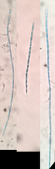 Lophium mytilinum