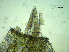 Ptychostomum imbricatulum