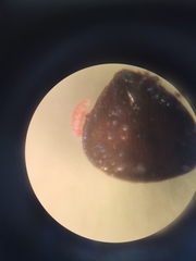 Bilobella braunerae