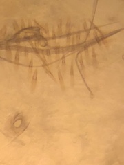 Aedes canadensis mathesoni