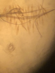 Aedes canadensis mathesoni