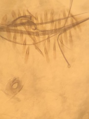 Aedes canadensis mathesoni