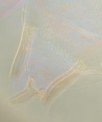 Hyperomyzus lactucae