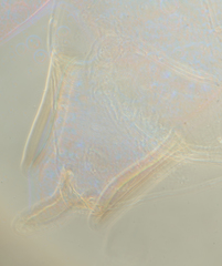 Hyperomyzus lactucae