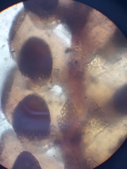 Frullania hodgsoniae