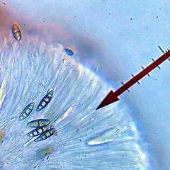 Eopyrenula intermedia