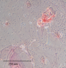Russellaspis pustulans