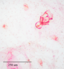Russellaspis pustulans