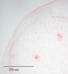 Russellaspis pustulans