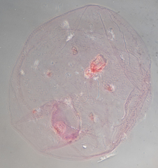 Russellaspis pustulans