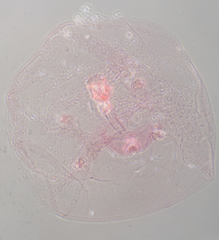 Russellaspis pustulans