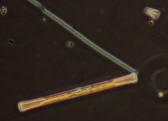 Ulnaria