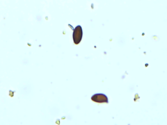 Hypoxylon perforatum