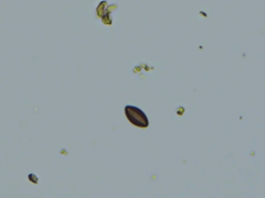 Hypoxylon perforatum