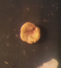 Tiphotrocha comprimata