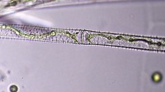 Gonatozygon monotaenium