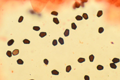 Coprinellus angulatus