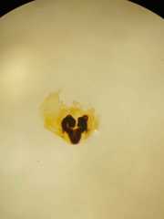 Oxyopes javanus