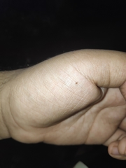 Rhipicephalus sanguineus