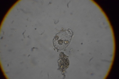 Euglypha strigosa