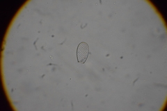 Euglypha rotunda
