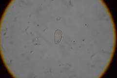 Euglypha rotunda