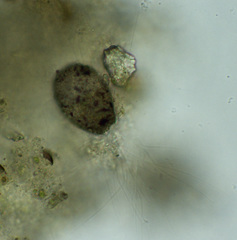 Cercozoa