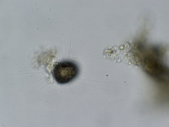 Cercozoa