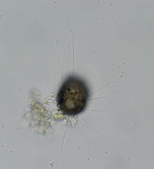 Cercozoa