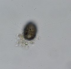 Cercozoa