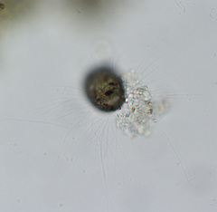 Cercozoa