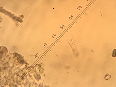Scoliciosporum pensylvanicum