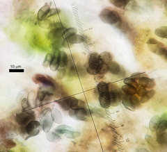 Amandinea dakotensis