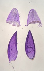 Sphagnum subsecundum