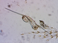 Kellicottia bostoniensis