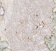 Pertusaria subpertusa