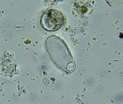 Cercozoa