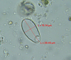 Cercozoa