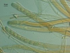 Peziza echinospora