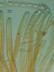Peziza echinospora