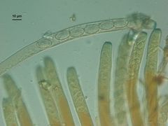 Peziza echinospora