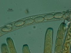 Peziza echinospora