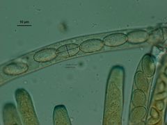 Peziza echinospora