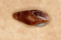 Isara carbonaria