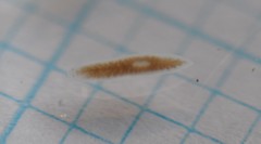 Dendrocoelum lacteum