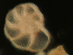 Foraminifera