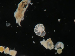 Foraminifera