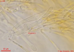 Parachnopeziza miniopsis