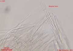 Parachnopeziza miniopsis