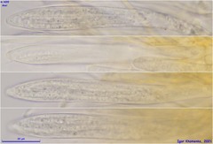 Parachnopeziza miniopsis